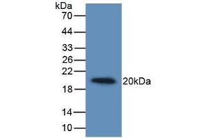 Detection of Recombinant IL19, Human using Monoclonal Antibody to Interleukin 19 (IL19) (IL-19 anticorps  (AA 25-177))