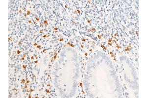 ABIN6267285 at 1/100 staining human appendiceal tissue sections by IHC-P.