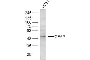 U251 Cells lysates probed with GFAP Polyclonal Antibody, unconjugated  at 1:300 overnight at 4°C followed by a conjugated secondary antibody at 1:10000 for 60 minutes at 37°C.