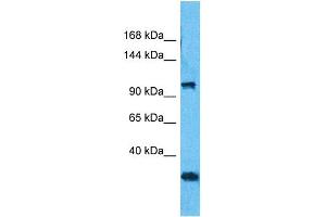 Host:  Rabbit  Target Name:  MORC3  Sample Type:  293T Whole Cell lysates  Antibody Dilution:  1. (MORC3 anticorps  (C-Term))