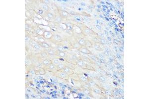 Immunohistochemistry of paraffin-embedded human esophageal using CCR7 Rabbit mAb (ABIN7266309) at dilution of 1:100 (40x lens).