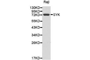 Western blot analysis of extracts of Raji cell lines, using SYK antibody.