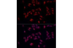 Immunofluorescence analysis of U2OS using SUPT16H (SPT16) antibody (ABIN7267097) at dilution of 1:100 (40x lens).