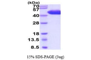 SDS-PAGE (SDS) image for CD5 (CD5) (AA 25-372) protein (His tag) (ABIN5854826)