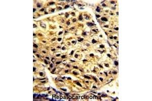 Immunohistochemistry (IHC) image for anti-Arylacetamide Deacetylase (Esterase) (AADAC) antibody (ABIN3002812)