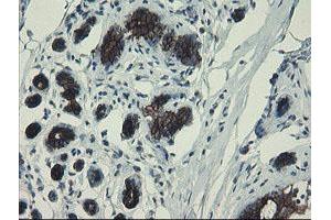 Immunohistochemical staining of paraffin-embedded Human breast tissue using anti-DPH2 mouse monoclonal antibody. (DPH2 anticorps)
