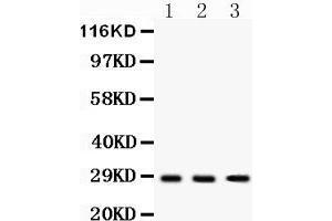 Western Blotting (WB) image for anti-Dickkopf 2 Homolog (DKK2) (AA 34-259) antibody (ABIN3043565) (DKK2 anticorps  (AA 34-259))