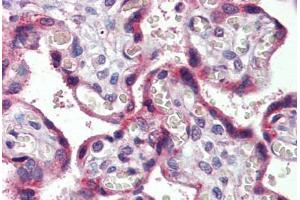 Placenta, Human: Formalin-Fixed, Paraffin-Embedded (FFPE)