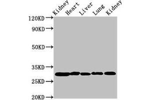 Western Blot Positive WB detected in: Rat kidney tissue, Rat heart tissue, Rat liver tissue, Mouse lung tissue, Mouse kidney tissue All lanes: CA2 antibody at 2 μg/mL Secondary Goat polyclonal to rabbit IgG at 1/50000 dilution Predicted band size: 30 kDa Observed band size: 30 kDa (CA2 anticorps  (AA 2-260))