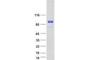 Validation with Western Blot