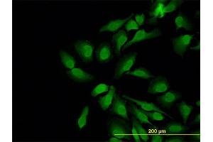 Immunofluorescence of monoclonal antibody to WASL on HeLa cell. (Neural Wiskott-Aldrich syndrome protein (WASL) (AA 97-184) anticorps)