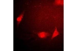 Immunofluorescent analysis of Sm E staining in Hela cells. (SNRPE anticorps)