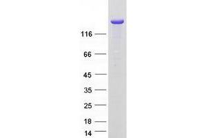 Validation with Western Blot
