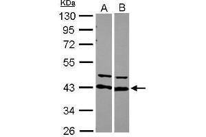 WB Image Sample (30 ug of whole cell lysate) A: 293T B: Raji 10% SDS PAGE antibody diluted at 1:10000 (HNRNPD/AUF1 anticorps)