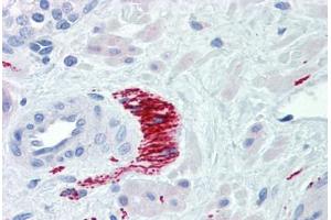 Human Prostate, Nerve (formalin-fixed, paraffin-embedded) stained with TH antibody ABIN462131 followed by biotinylated goat anti-rabbit IgG secondary antibody ABIN481713, alkaline phosphatase-streptavidin and chromogen.