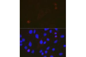 Immunofluorescence analysis of C6 cells using T Rabbit mAb (ABIN7270916) at dilution of 1:100 (40x lens).