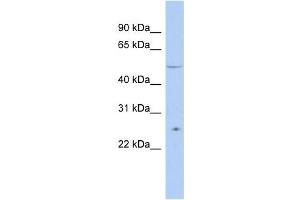 TTC8 antibody used at 1 ug/ml to detect target protein. (TTC8 anticorps  (N-Term))