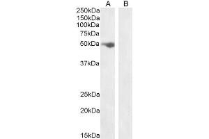 ABIN184815 (1ug/ml) staining of Human Ovary lysate (A) + peptide (B) (35µg protein in RIPA buffer).