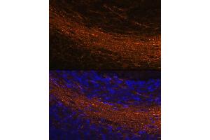 Immunofluorescence analysis of rat brain using CNPase Rabbit mAb (ABIN7265322) at dilution of 1:100 (40x lens). (Cnpase anticorps)