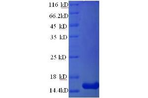 SDS-PAGE (SDS) image for Tetraspanin 7 (TSPAN7) (AA 113-223), (Extracellular) protein (His tag) (ABIN5713916)