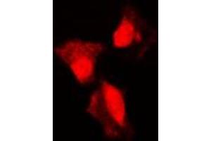 Immunofluorescent analysis of p53 (pS315) staining in A431 cells. (p53 anticorps  (C-Term, pSer315))