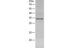 Western Blotting (WB) image for Dystroglycan 1 (DAG1) (AA 30-312) protein (His tag) (ABIN7122728)