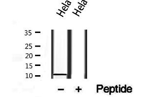 Western blot analysis of extracts from Hela, using S100A14 antibody. (S100A14 anticorps  (N-Term))