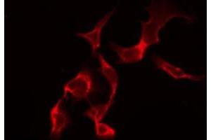 ABIN6268965 staining HuvEc by IF/ICC. (HNRNPD/AUF1 anticorps  (Internal Region))