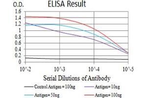 Black line: Control Antigen (100 ng),Purple line: Antigen (10 ng), Blue line: Antigen (50 ng), Red line:Antigen (100 ng)
