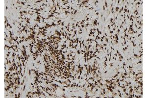 ABIN6277117 at 1/100 staining Human gastric tissue by IHC-P. (ZYX anticorps  (Internal Region))