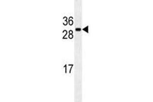 CDCA8 antibody western blot analysis in U251 lysate (CDCA8 anticorps)