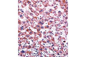 CYP2C9 Antibody immunohistochemistry analysis in formalin fixed and paraffin embedded human liver tissue followed by peroxidase conjugation of the secondary antibody and DAB staining. (CYP2C9 anticorps  (N-Term))
