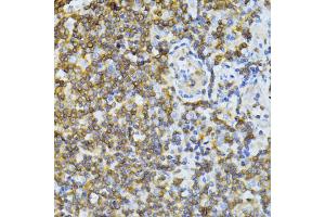 Immunohistochemistry of paraffin-embedded human tonsil using ND5 antibody (ABIN6294088) at dilution of 1:100 (40x lens). (MT-ND5 anticorps)
