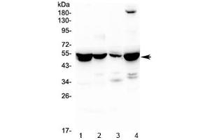Western blot testing of 1) rat liver, 2) rat kidney, 3) rat lung and 4) mouse liver lysate with ASL antibody at 0.