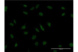 Immunofluorescence of monoclonal antibody to ZBTB20 on HeLa cell. (ZBTB20 anticorps  (AA 451-542))
