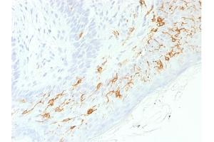 Formalin-fixed, paraffin-embedded human Skin stained with CD1a-Monospecific RecombinantRabbit Monoclonal Antibody (C1A/1506R). (Recombinant CD1a anticorps)