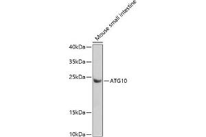 Western blot analysis of extracts of mouse small intestine, using  antibody (ABIN6133192, ABIN6137243, ABIN6137244 and ABIN6223255) at 1:1000 dilution.