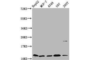Western Blot Positive WB detected in: HepG2 whole cell lysate, MCF-7 whole cell lysate, A549 whole cell lysate, U87 whole cell lysate, 293T whole cell lysate All lanes: CSTB antibody at 5. (CSTB anticorps  (AA 1-98))