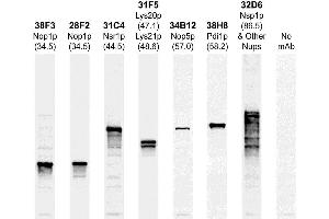 The Western blots of whole yeast protein extracts with a collection of our antibodies. (PDI1 anticorps)