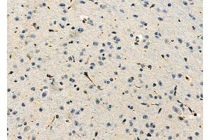ABIN6263343 and ABIN6276818 at 1/100 staining Mouse brain tissue by IHC-P. (MPZ anticorps  (C-Term))