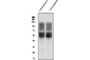 Western blot analysis of SLC2A1 using anti-SLC2A1 antibody (ABIN6719416).
