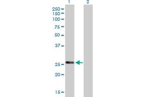 Western Blot analysis of KLK7 expression in transfected 293T cell line by KLK7 MaxPab polyclonal antibody. (Kallikrein 7 anticorps  (AA 1-253))