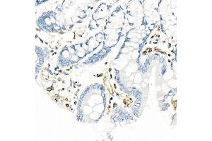 Immunohistochemistry of paraffin-embedded rat colon using QKI Rabbit mAb (ABIN7269699) at dilution of 1:1000 (40x lens).