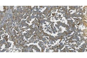 IHC analysis of K Cadherin/CDH6 using anti-K Cadherin/CDH6 antibody (ABIN7600136).