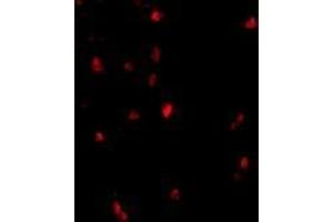 Immunofluorescence of cbl in human lymph node tissue with AP30209PU-N cbl antibody at 20 μg/ml. (CBL anticorps  (C-Term))