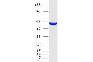 Validation with Western Blot