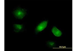 Immunofluorescence of purified MaxPab antibody to VAC14 on HeLa cell. (VAC14 anticorps  (AA 1-782))