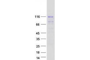 Validation with Western Blot