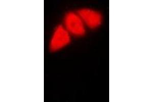 Immunofluorescent analysis of p53 staining in HeLa cells. (p53 anticorps  (N-Term))