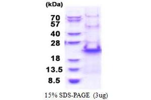 SDS-PAGE (SDS) image for Ribosomal Protein S20 (RPS20) (AA 1-142) protein (His tag) (ABIN5853428) (RPS20 Protein (AA 1-142) (His tag))